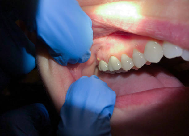 Emergency Gum Pain Relief in KS